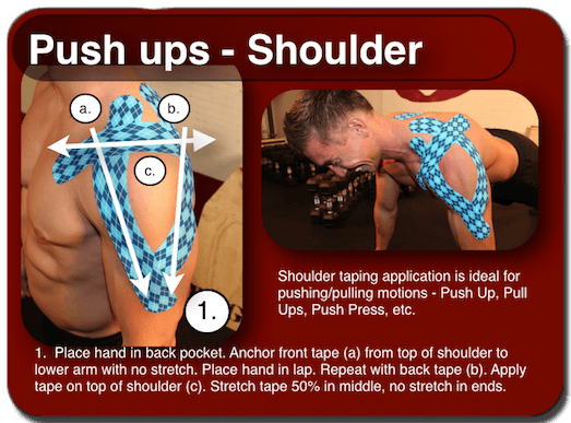 RockTape for Shoulder Pain Brookvale Manly Northern Beaches