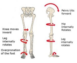 The Affects of pronated feet