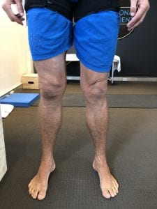 Leg Size pre Blood Flow Restriction Training